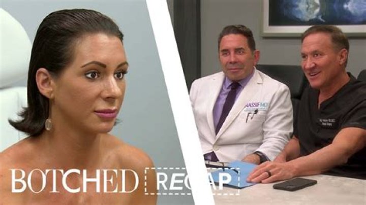 Botched Recap 7/20/14: Season 1 Episode 5 “Like a Surgeon”