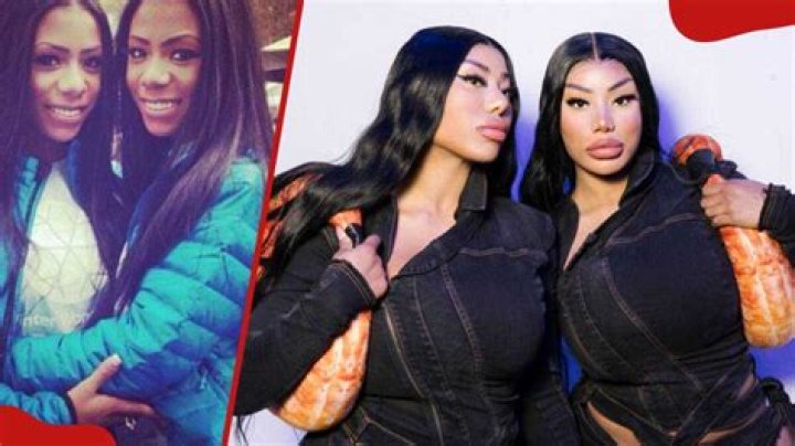 Clermont Twins Plastic Surgery: Before And After Looks